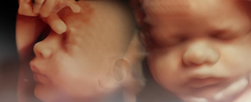 4D/5D Pregnancy Scan